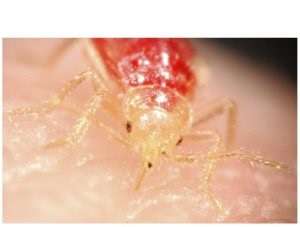 Everything you ever wanted to know about Bed Bugs