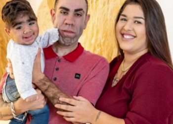 Our adorable hairy baby has a legion of fans – they say he can grow a beard better than most men