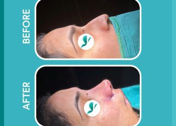 Trusted by Thousands: Luviacure’s Patient-Centered Approach Transforms Medical Tourism